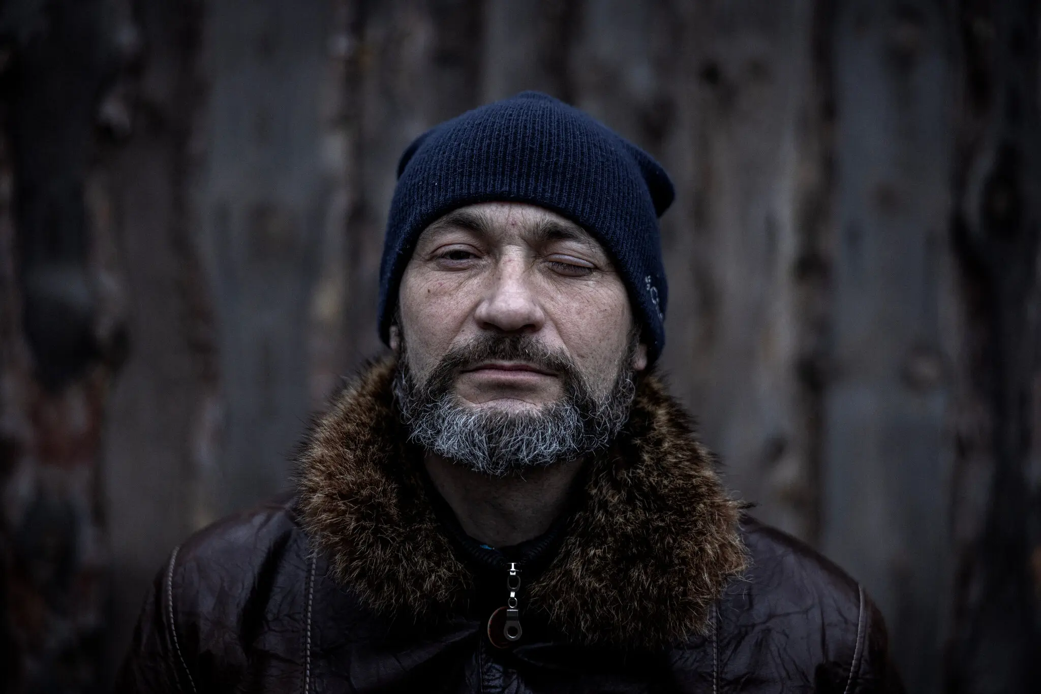 Сержант 46-річний Олександр, старшина піхотного взводу, відновлюється після поранень, отриманих під час боїв у Росії.